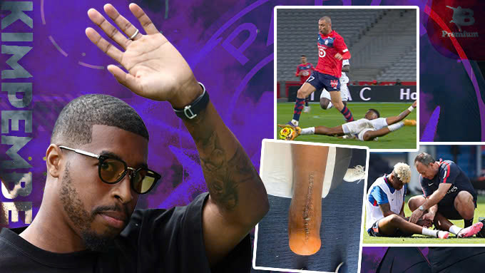 Presnel Kimpembe là biểu tượng văn hóa của PSG
