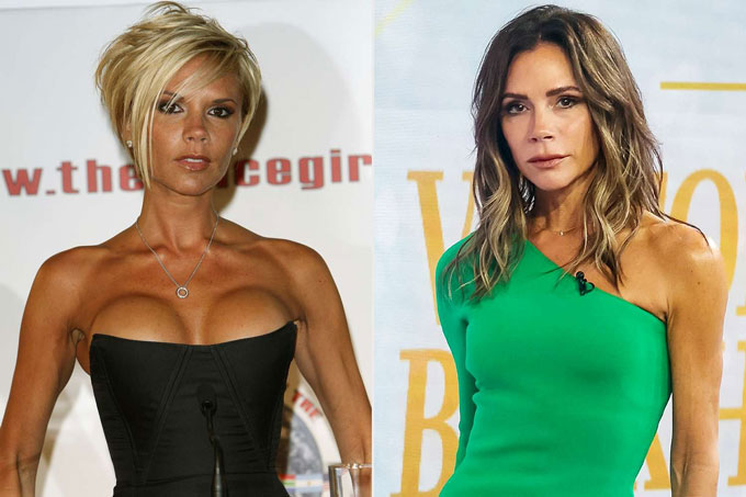 Victoria Beckham vứt bỏ túi độn ngực