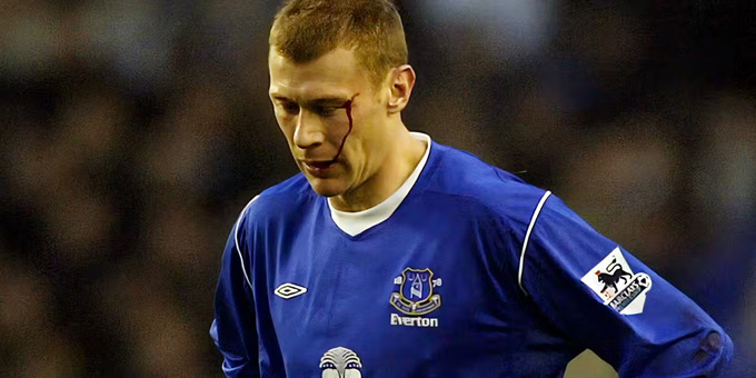 Duncan Ferguson