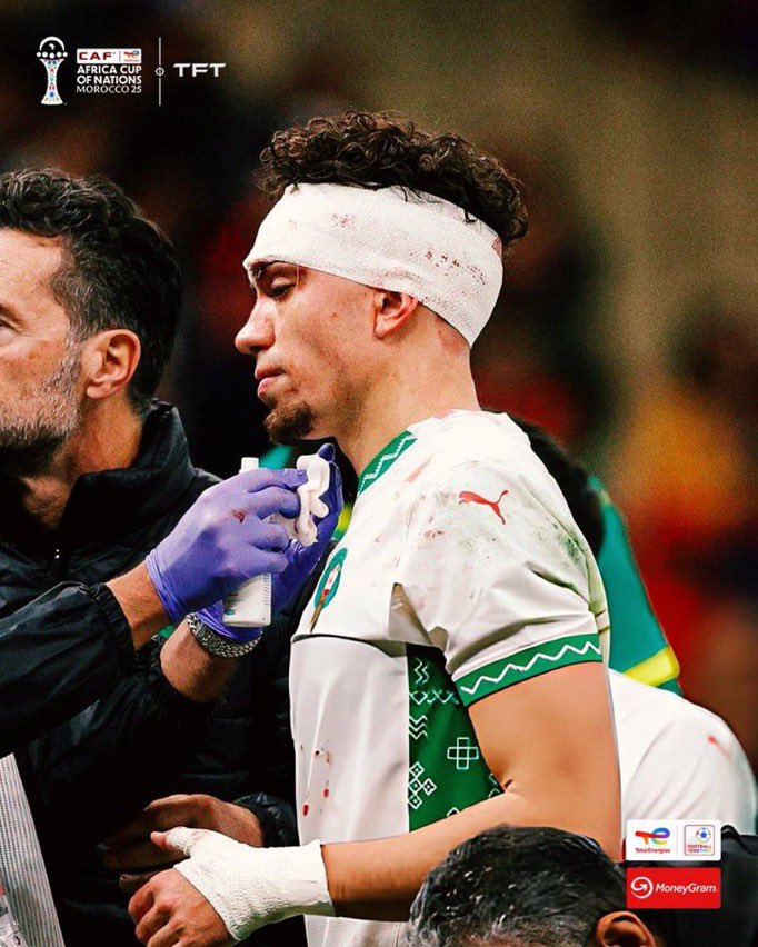 El Aynaoui đổ máu đầu sau pha tranh chấp