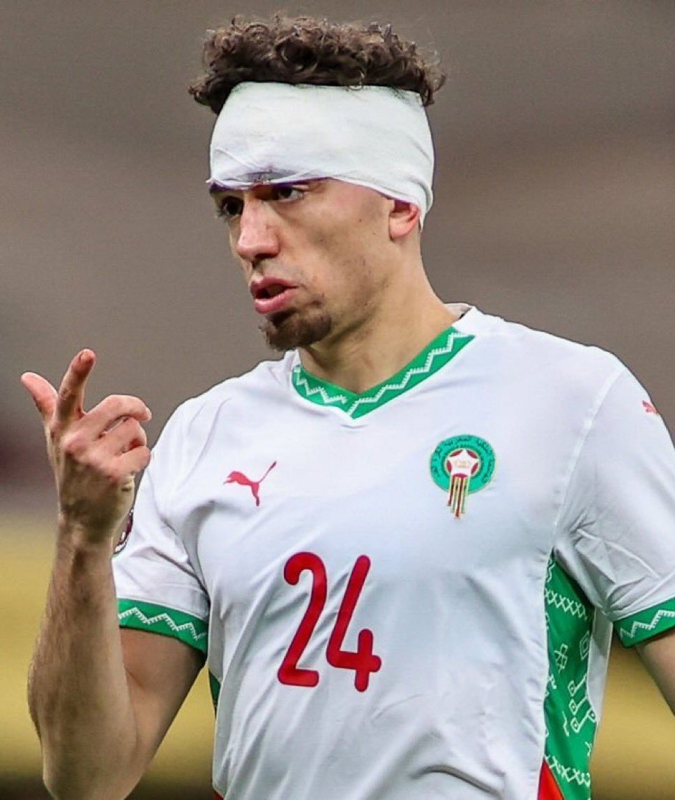 El Aynaoui xứng đáng được khen ngợi khi thi đấu quả cảm