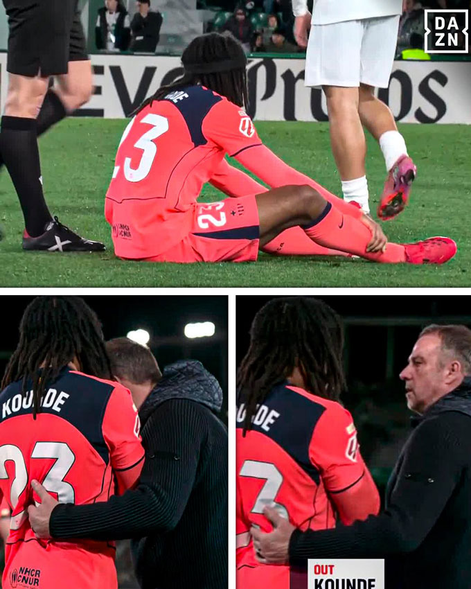 Kounde bị đau rời sân nhưng chấn thương không quá nặng