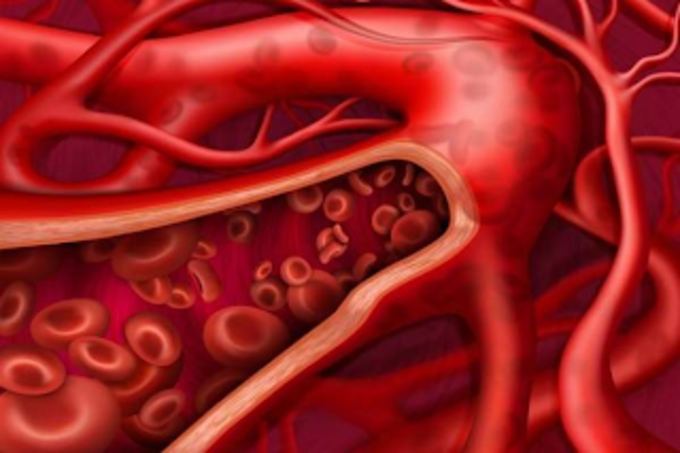 Khí huyết kém lưu thông là nguyên nhân khiến viêm nang lông xuất hiện.