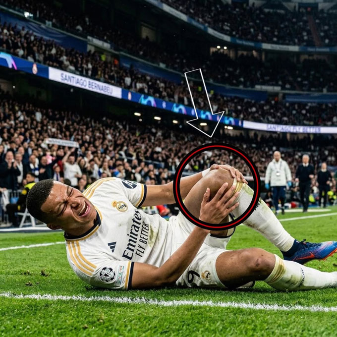 Mbappe đang gặp chấn thương