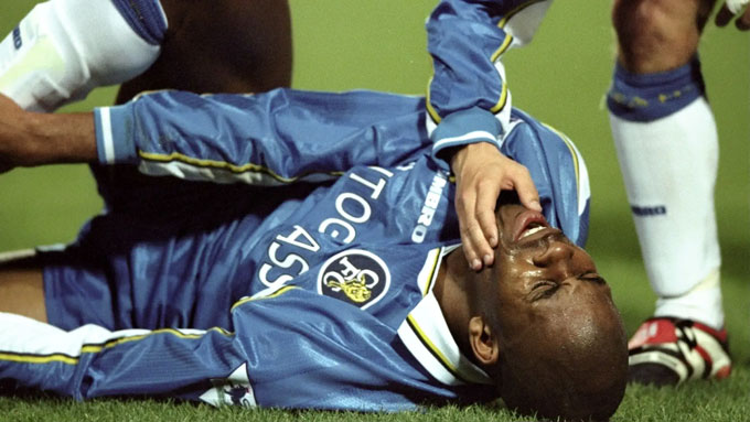 Duberry bất ngờ bị liệt nửa mặt ngay trước trận chung kết