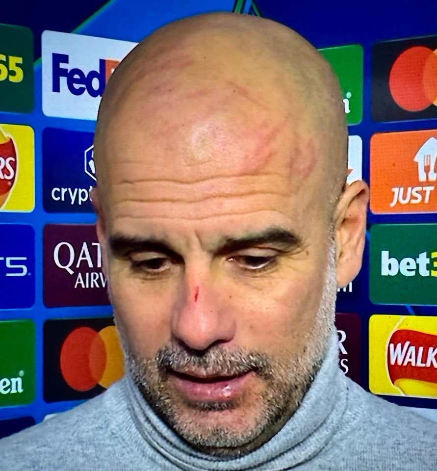 Hình ảnh Pep Guardiola được cho tự làm tổn thương - Ảnh: The Sun
