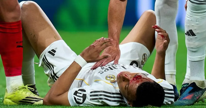 Mbappe nằm sân sau tình huống va chạm