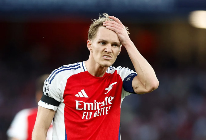 Khả năng ra sân của Odegaard bị bỏ ngỏ