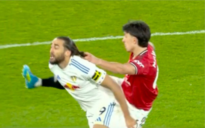 Tình huống Lisandro kéo tóc Calvert-Lewin - Ảnh: Instagram