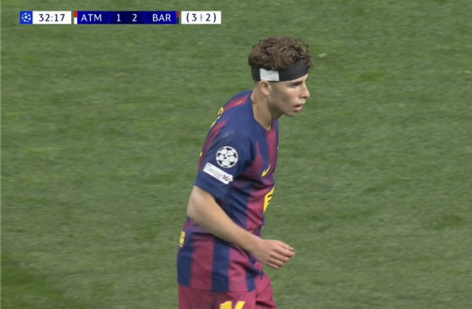 Sau khi Lopez băng đầu và thi đấu trở lại, Barca đã bị rút ngắn cách biệt xuống còn 1-2. Ảnh - The Football Lab