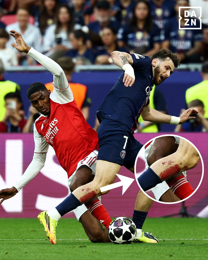 Kvaratskhelia mang về quả penalty quyết định cho Arsenal và lộ ra hình ảnh chảy máu ở chân - Ảnh: DAZN