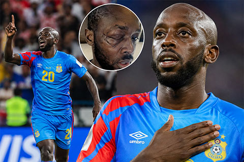 Yoane Wissa vừa ghi bàn giúp CHDC Congo cầm hòa Bồ Đào Nha