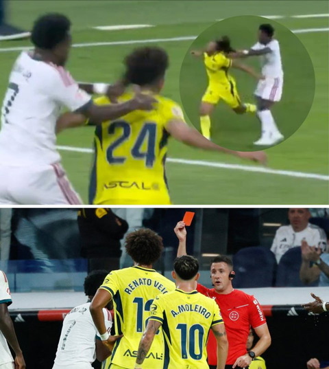 Hành vi kéo tóc của Vinicius