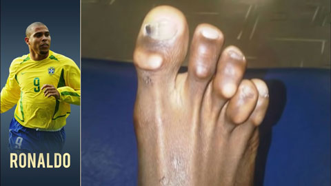 Bàn chân của các siêu sao sân cỏ có gì đặc biệt?