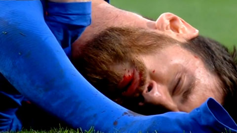 Cận cảnh pha va chạm với Marcelo khiến Messi đổ máu
