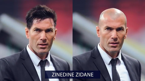 Pep Guardiola, Zidane nhìn thế nào khi có thêm...tóc?