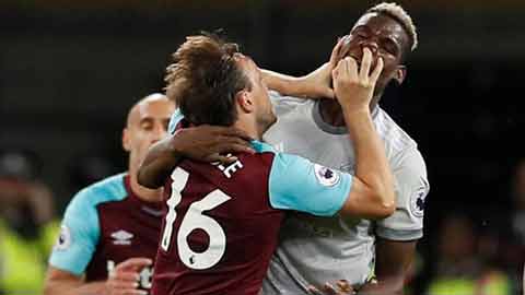 Pogba và Noble: yêu nhau lắm, đánh nhau đau