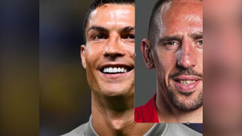  Khi mặt Ronaldo và Ribery kết hợp với nhau thì sẽ thế nào