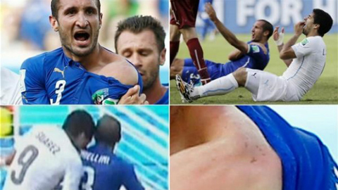 Ngày này 5 năm trước, Suarez cắn Chiellini