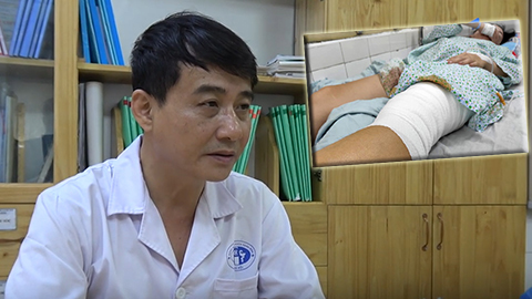Nữ CĐV bị bỏng vì pháo sáng mất da đùi trái, phẫu thuật trong 3-4 ngày nữa