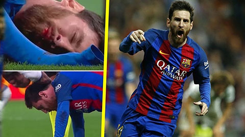 Điều gì sẽ xảy ra khi đối phương cố tình triệt hạ Messi?