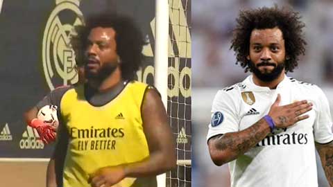 Marcelo ngả người móc bóng khiến đồng đội lác mắt