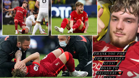 HLV Klopp sốc khi thấy chân Harvey Elliott bị biến dạng