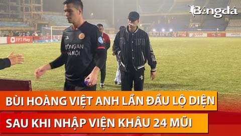  Bùi Hoàng Việt Anh xuất hiện với giao diện 'lạ' sau khi nhập viện khâu 24 mũi