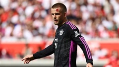 Dũng cảm đưa mặt ra đỡ bóng, Eric Dier chảy máu đầm đìa