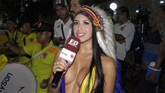 ‘Bom sex’ thả rông vòng một vì James Rodriguez