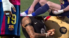 Barcelona dính cáo buộc doping từ… băng cổ tay