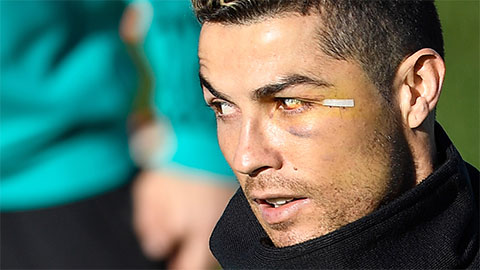 Cristiano Ronaldo đánh nhau với đồng đội