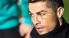 Cristiano Ronaldo đánh nhau với đồng đội
