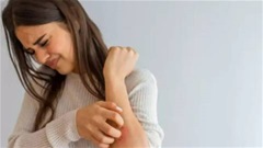 Bệnh vảy nến có lây không?