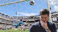 5 việc Xabi Alonso cần làm sau thất bại của Real Madrid
