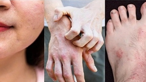 Phương thuốc nổi tiếng trị bệnh ngoài da - Bảo Thanh Đường