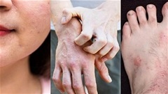 Phương thuốc nổi tiếng trị bệnh ngoài da - Bảo Thanh Đường