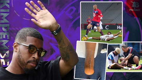 Muốn hiểu ‘văn hóa PSG’, hãy nhìn vào Presnel Kimpembe