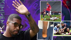 Muốn hiểu ‘văn hóa PSG’, hãy nhìn vào Presnel Kimpembe