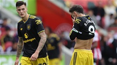 Bruno Fernandes hỏng 11 mét vì chiêu độc của HLV phía Brentford
