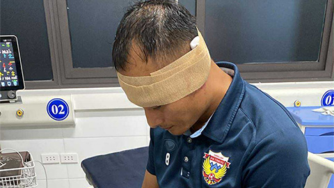 Thông tin mới nhất về chấn thương của Trọng Hoàng