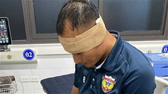 Thông tin mới nhất về chấn thương của Trọng Hoàng