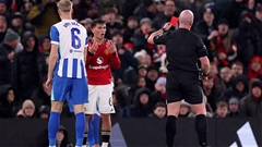 'Shea Lacey nhận thẻ đỏ do biết đau vì MU'