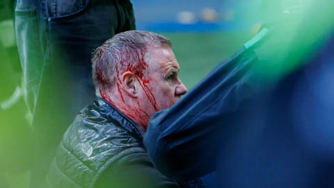 Ẩu đả kinh hoàng ở trận derby kinh điển Scotland