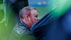 Ẩu đả kinh hoàng ở trận derby kinh điển Scotland