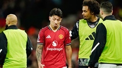 Lisandro Martinez có não không?