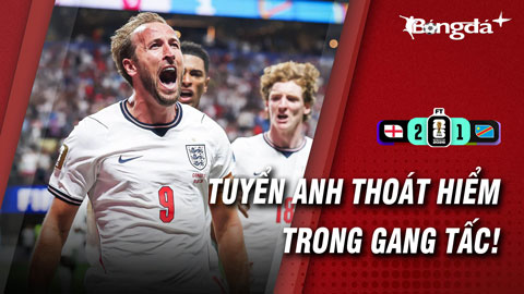 ĐT Anh hú vía trước Congo: Thắng đấy như lo đấy!
