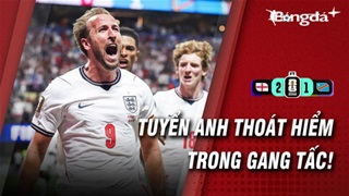 ĐT Anh hú vía trước Congo: Thắng đấy như lo đấy!