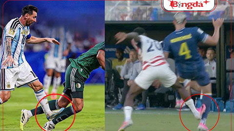 Messi vô can, Balogun lĩnh án: Công bằng ở đâu?