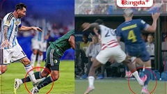 Messi vô can, Balogun lĩnh án: Công bằng ở đâu?